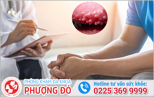 Chuỗi Hạt Ngọc Dương Vật Có Gây Vô Sinh Không?