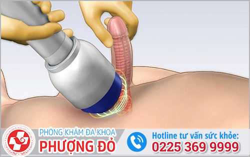  Tại sao sóng xung kích lại có tác dụng trong điều trị rối loạn cương dương?