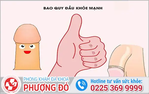 Lợi ích của việc nong bao quy đầu